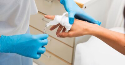 Wound Care
